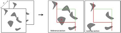 Application of the Physical Disector Principle for Quantification of Dopaminergic Neuronal Loss in a Rat 6-Hydroxydopamine Nigral Lesion Model of Parkinson's Disease